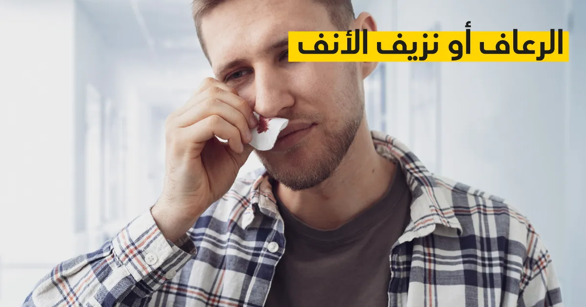 الرعاف أو نزيف الأنف